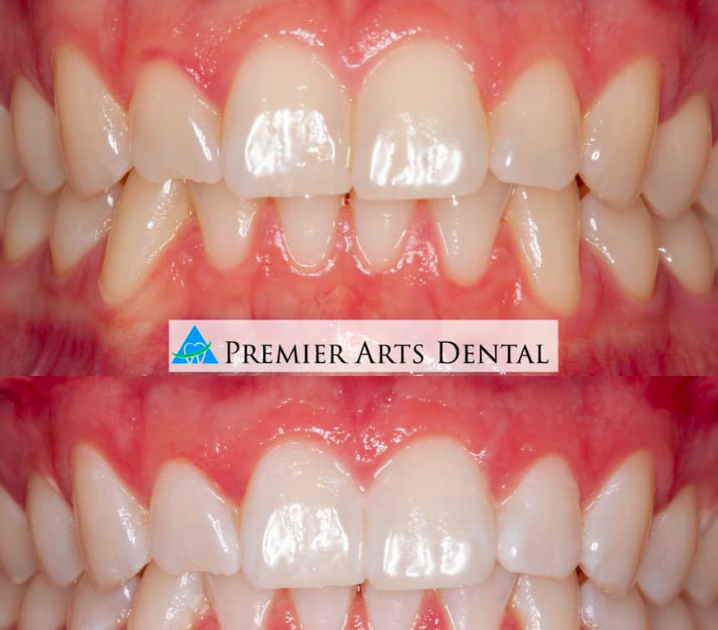 Images Premier Arts Dental