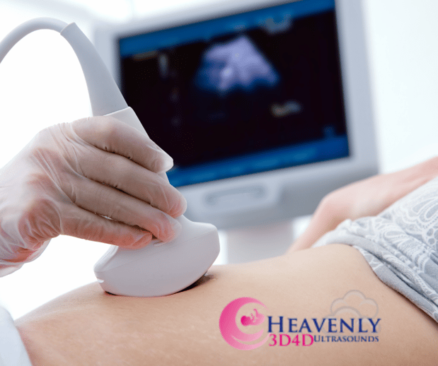 Images Heavenly 3D 4D Ultrasounds