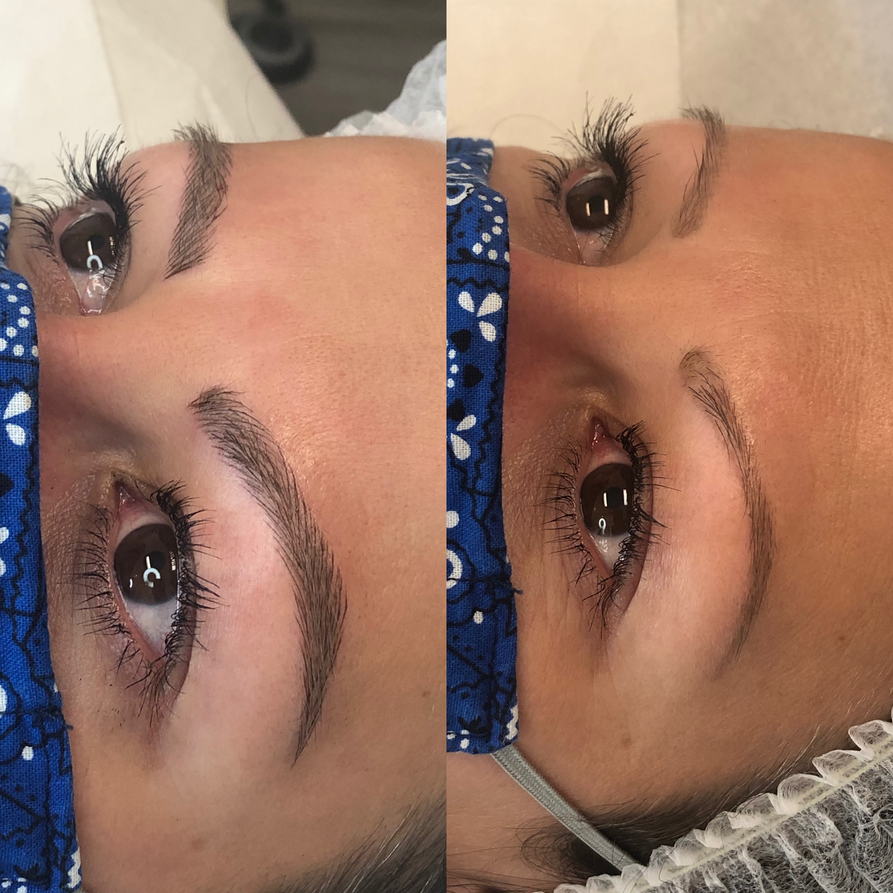 Images Clinique d'Esthétique Leila - Hydrafacial, Microblading, Épilation Laser Sainte-Foy