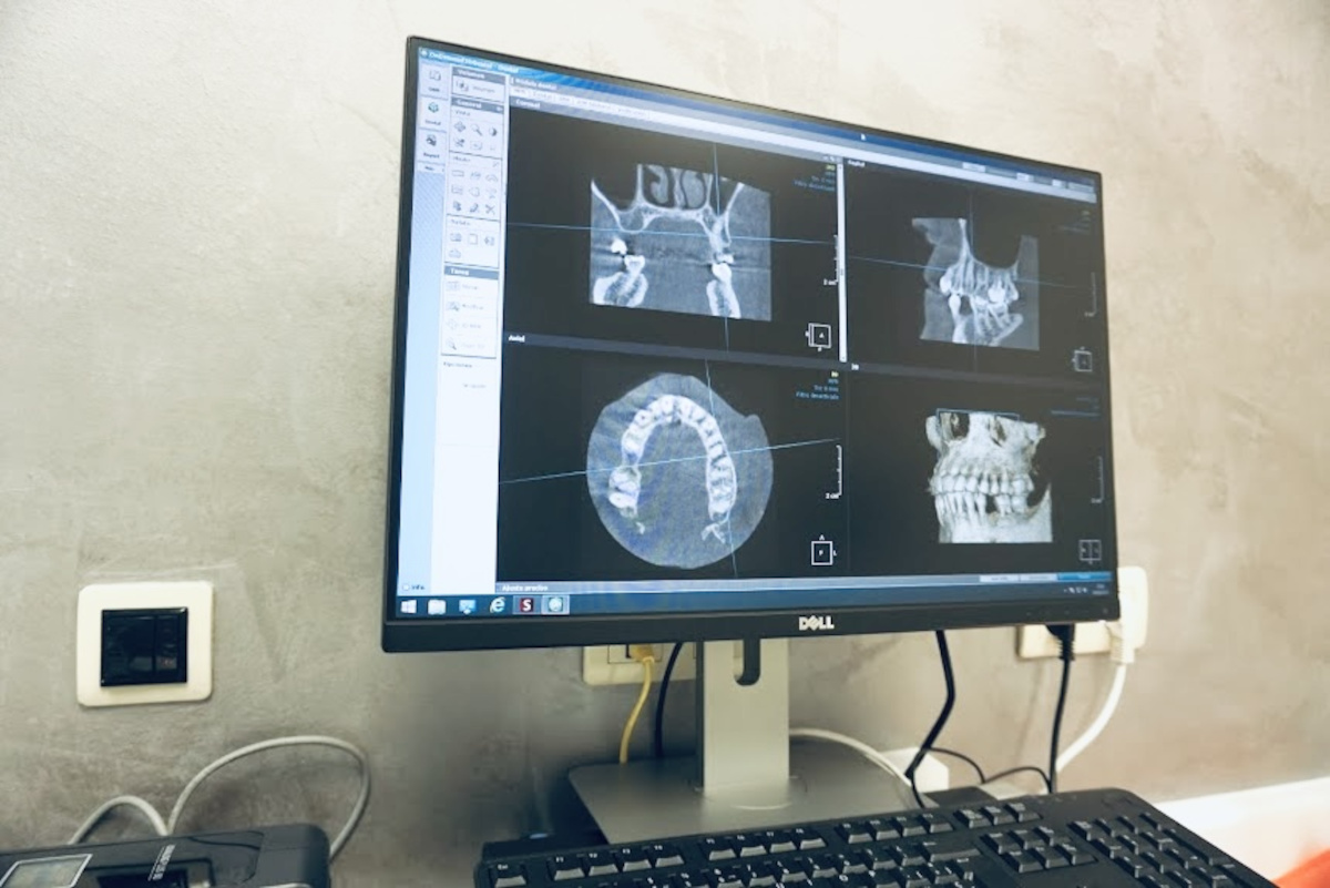 Images Clínica Dental Novabur | Dentista en Burgos | Implantes dentales | Odontopediatría