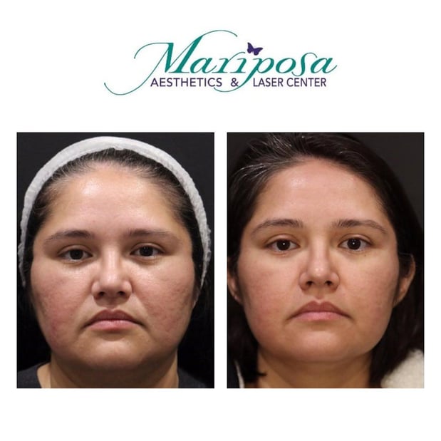 Images Mariposa Aesthetics & Laser Center