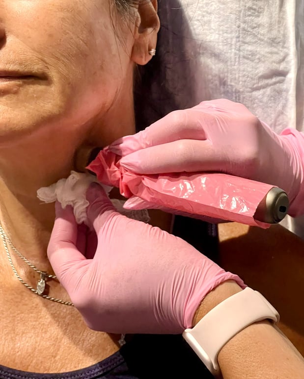 Images So Vein Therapies