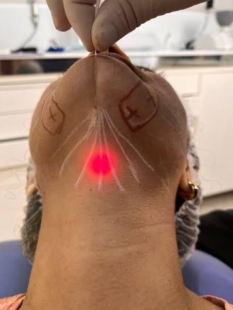 Images ProSculpt Med Spa