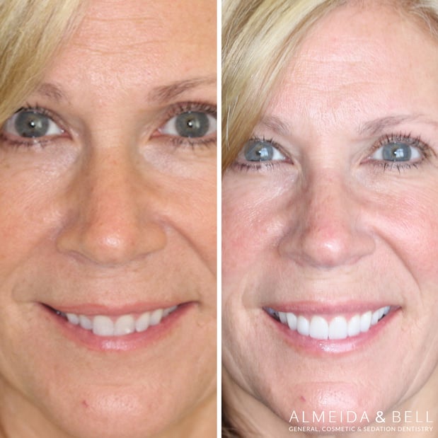 Images Almeida & Bell Dental Lone Tree - General, Cosmetic, and Implant Dentistry