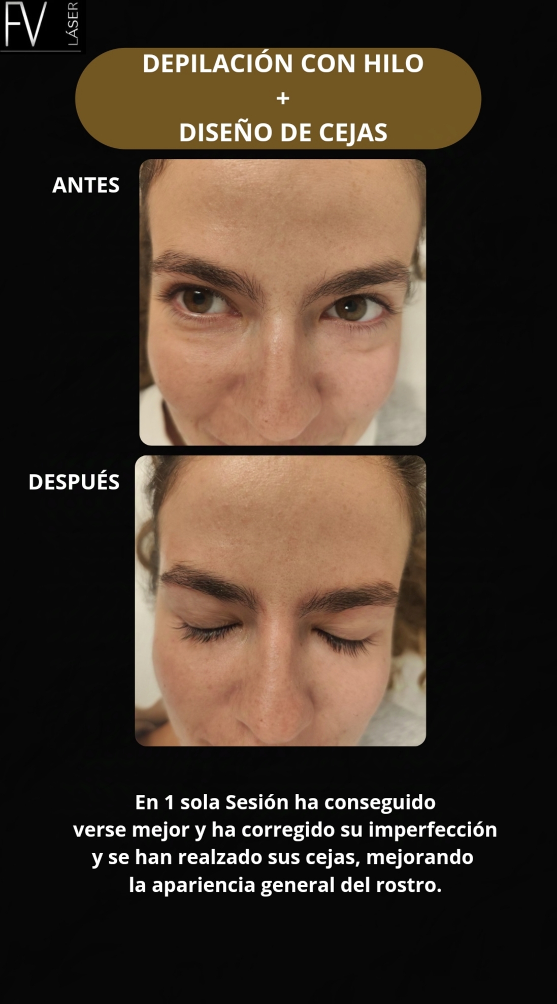 Images Fv Láser Nails Beauty