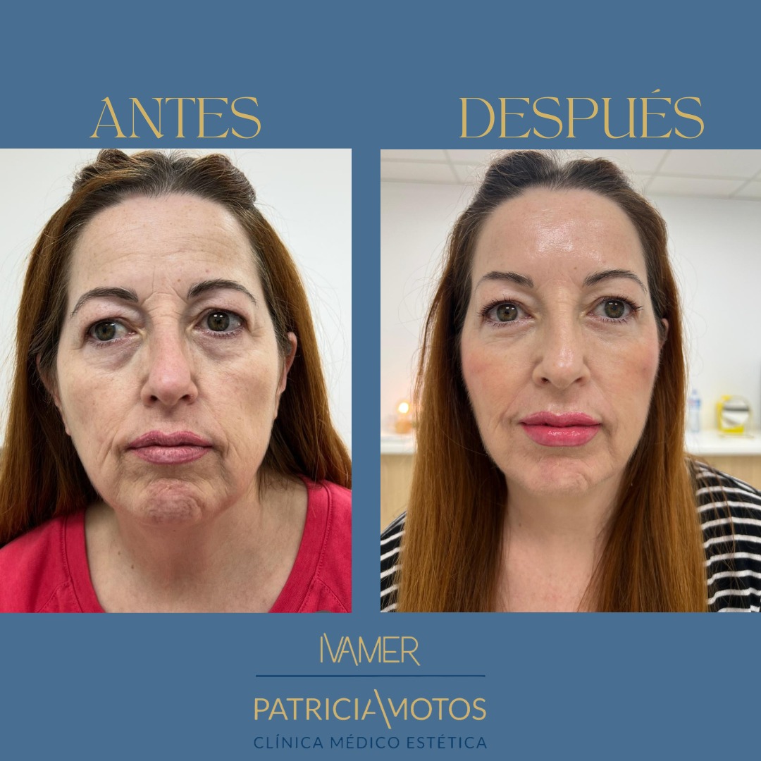 Images Ivamer Patricia Motos - Clínica Médico Estética