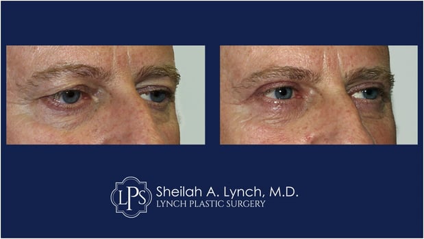 Images Dr. Sheilah A. Lynch