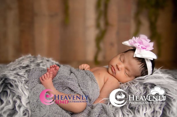 Images Heavenly 3D 4D Ultrasounds-Upland