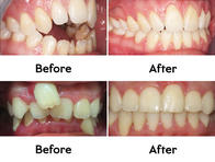 Image 4 | Dentist Huntington Beach CA - Dr. Sam Ayoub, DDS