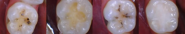 Images LaFayette Dental Associates
