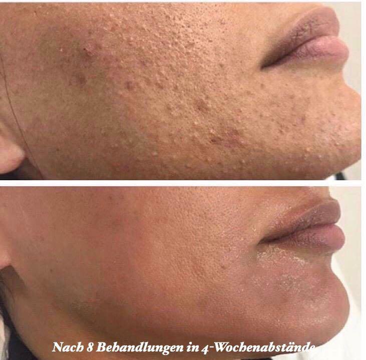 Schönheitssalon Ilaria, Eichenweg 20 in Jettingen-Scheppach