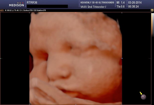 Images Heavenly 3D 4D Ultrasounds-Upland