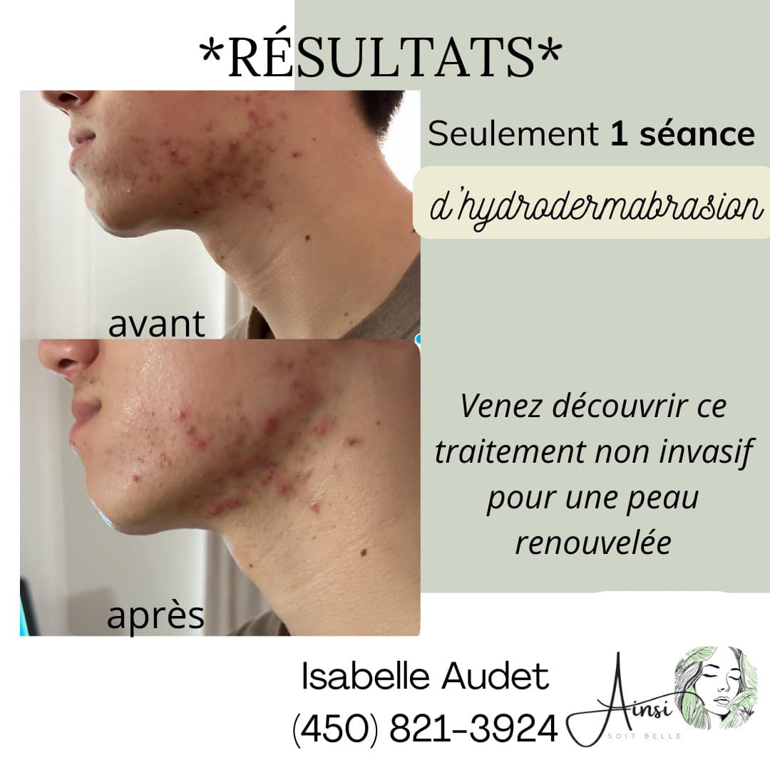 Images Ainsi soit belle - Esthétique Saint-Jérôme