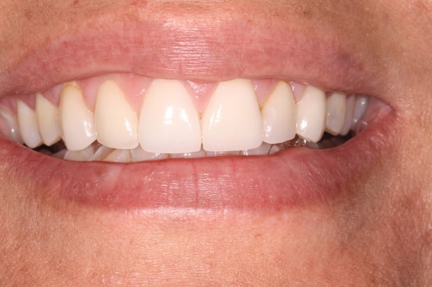 Images North Salem Dental Care