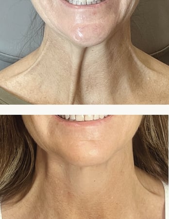 Images Injections and Co.
