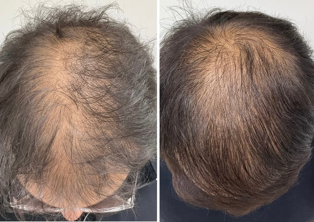 Images DERMADUO Platelet Rich Plasma & Wellness Clinic