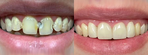 Images Riverside Family Dental