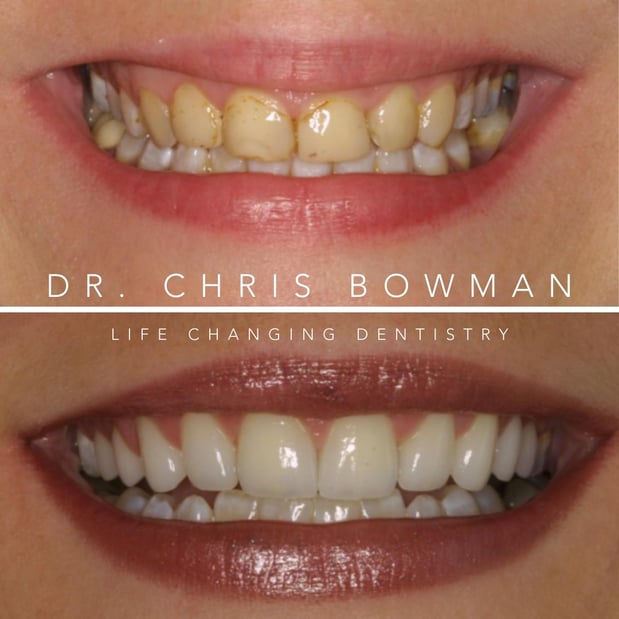 Images Advanced Dentistry of Charlotte