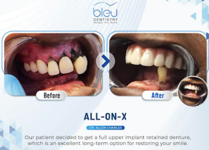 Images Bleu Dentistry