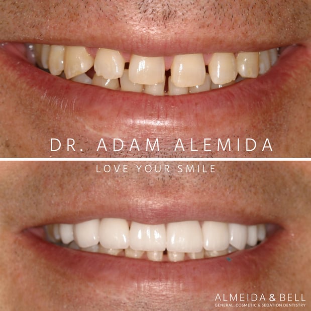 Images Almeida & Bell Dental Lone Tree - General, Cosmetic, and Implant Dentistry