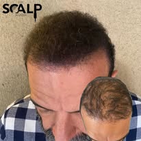 Images The Scalp Master