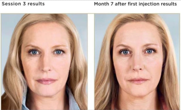 Images Renew Body Contouring & MedSpa