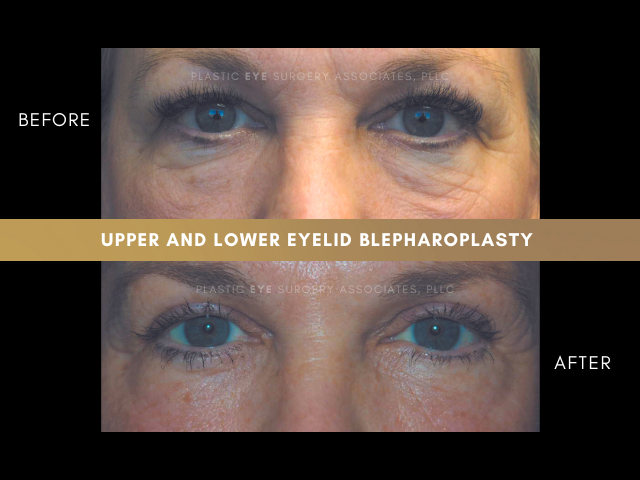 Images Plastic Eye Surgery Associates, PLLC