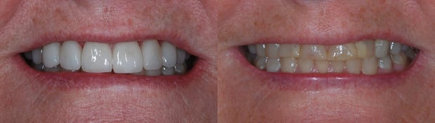 Images Today's Dental Care