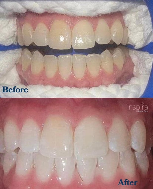 Images Inspira Dental Care