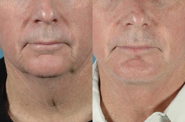 Images Rejuvenis Facial Cosmetic Surgery and Medical Spa