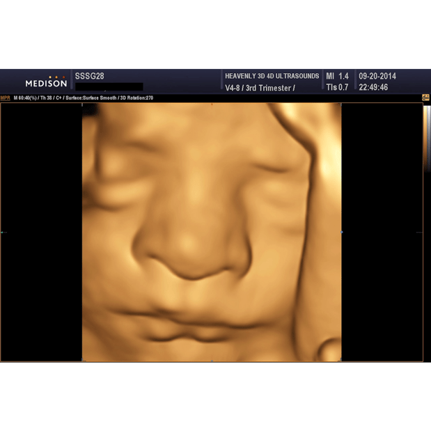 Images Heavenly 3D 4D Ultrasounds