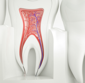 Sparkle Dental Explains Endodontics in Warren, MI