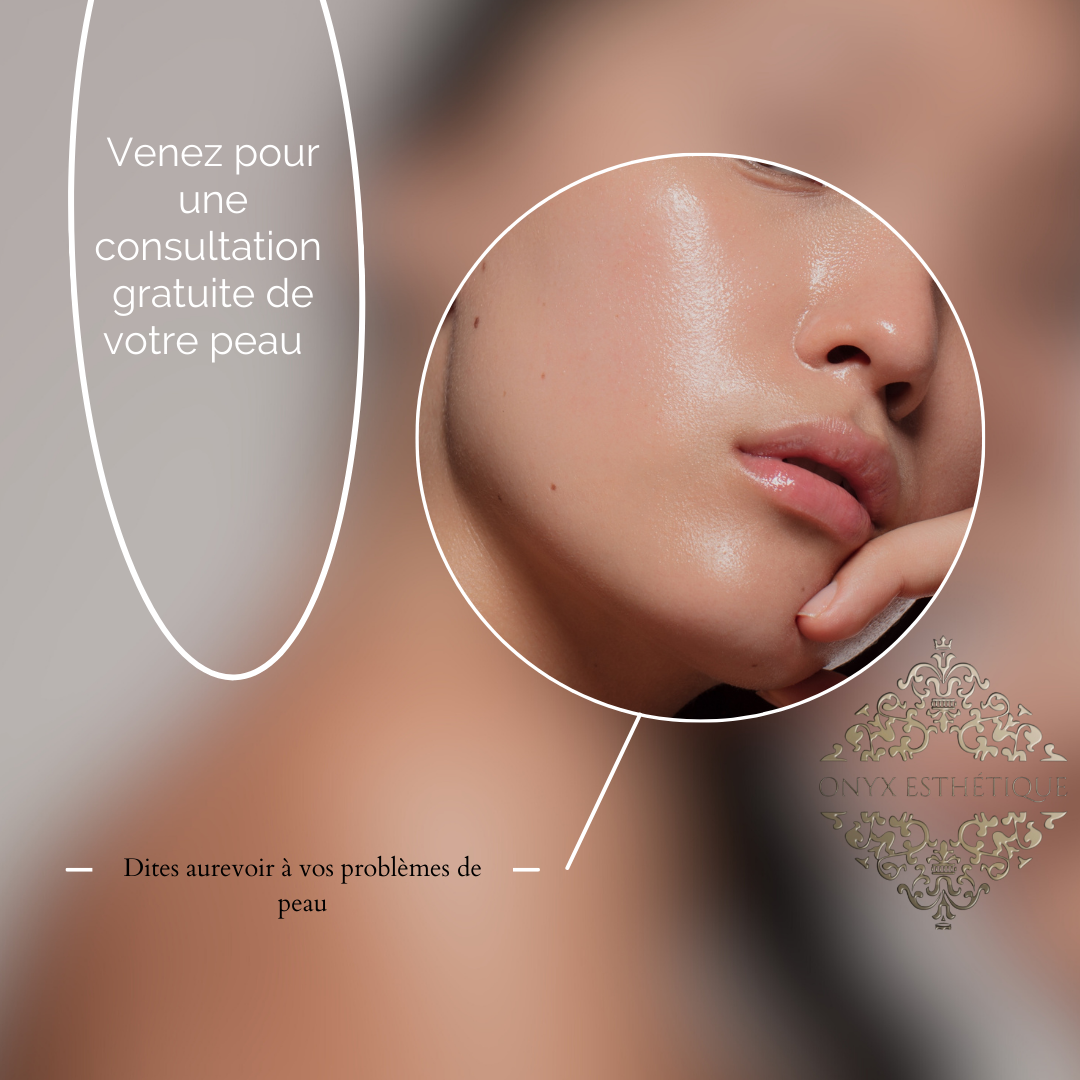 Images Onyx Esthétique - Soins esthétiques, Soins de la peau, Laser Cynosure Gatineau