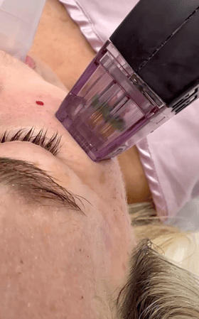 Images Semira Bayati, MD, FACS