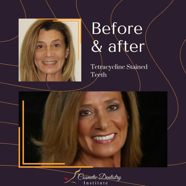 Images Cosmetic Dentistry Institute