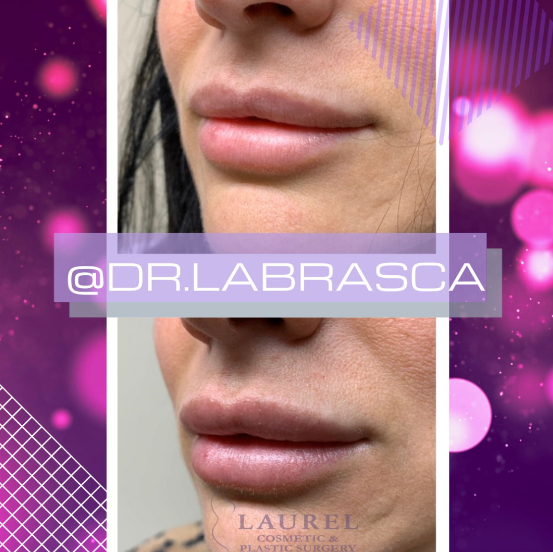 Laurel Cosmetic and Plastic Surgery: Algie LaBrasca, DO