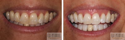 Images Exceptional Dentistry of the Tri-State Region