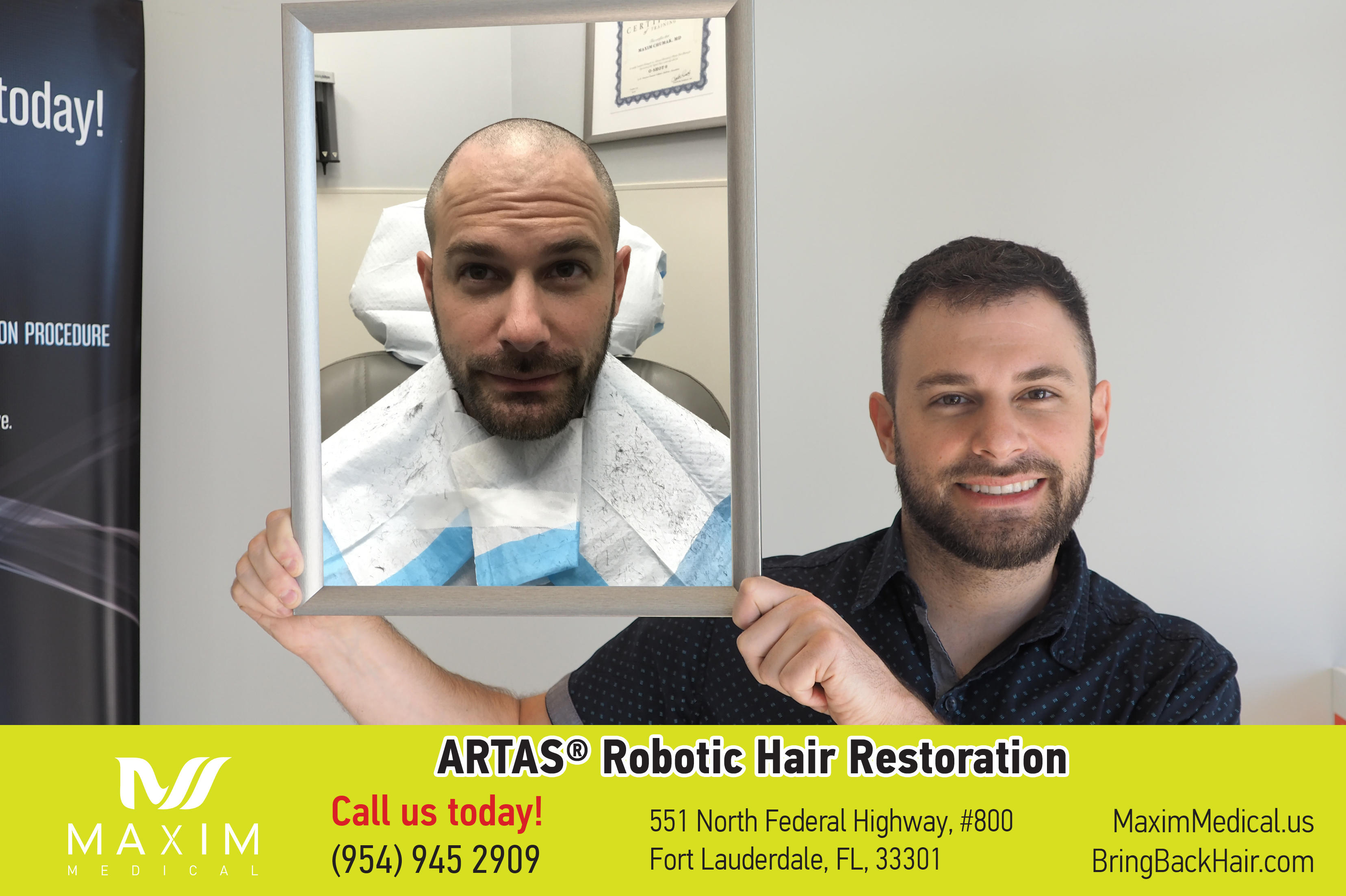 Amazing transformation following ARTAS robotic hair transplant surgery