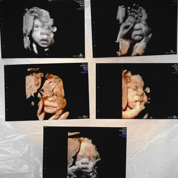 Images Love At First Sight 3D/4D Ultrasound Imaging Studio, LLC