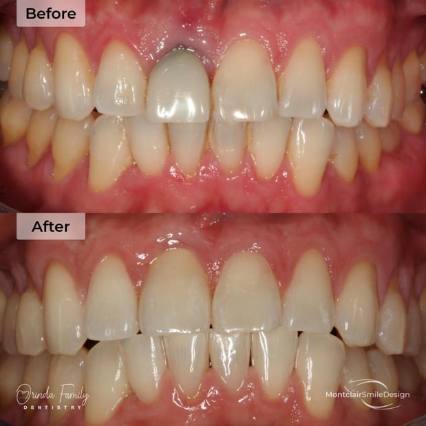 Images Orinda Family Dentistry