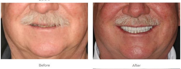 Images Aspen Ridge Dental