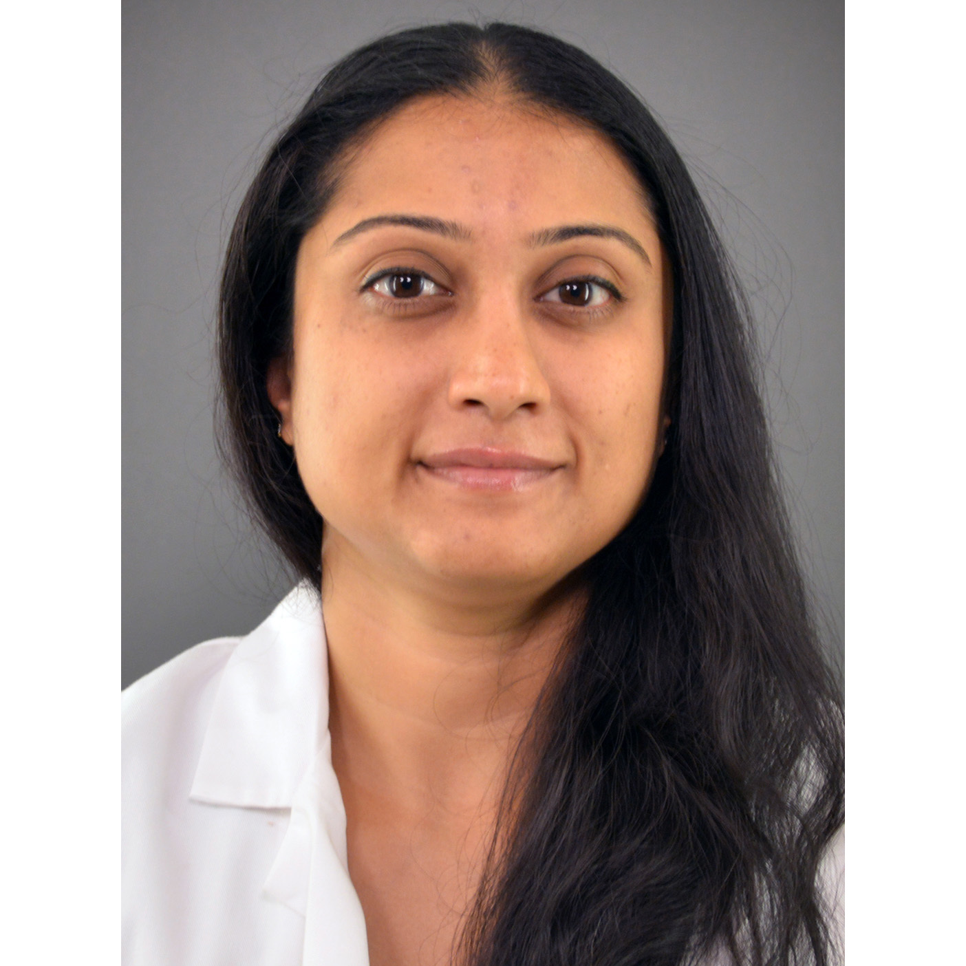 Dr. Nina Narasimhadevara, MD