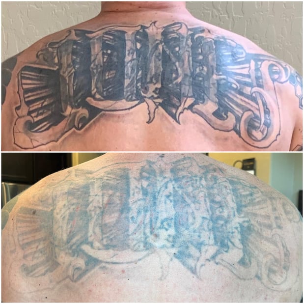 Images TruCanvas Aesthetics