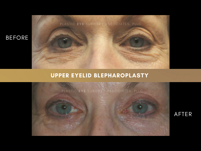 Images Plastic Eye Surgery Associates, PLLC