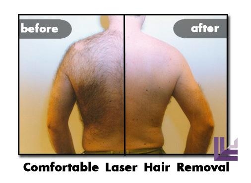 Images St. Louis Laser Liposuction Center