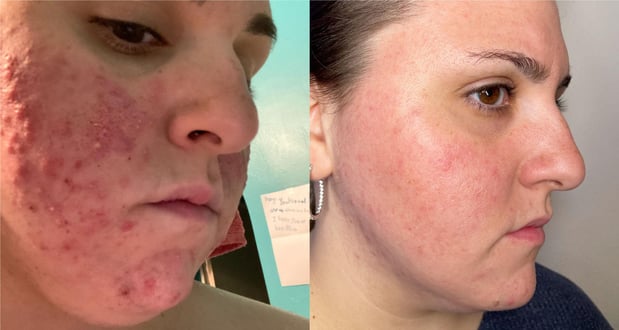 Images Face of Jules