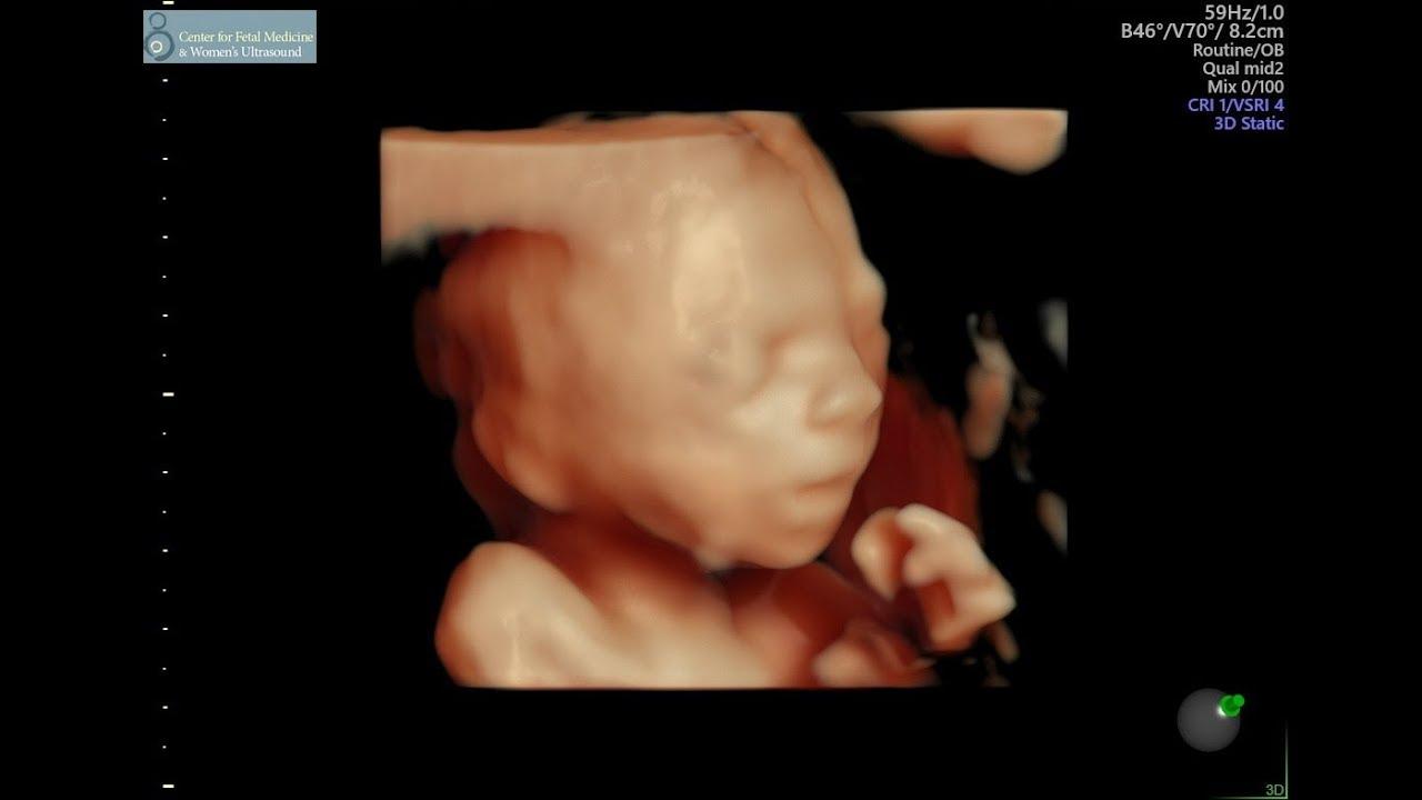 Fotos - PHOENIX ULTRASOUND - 17