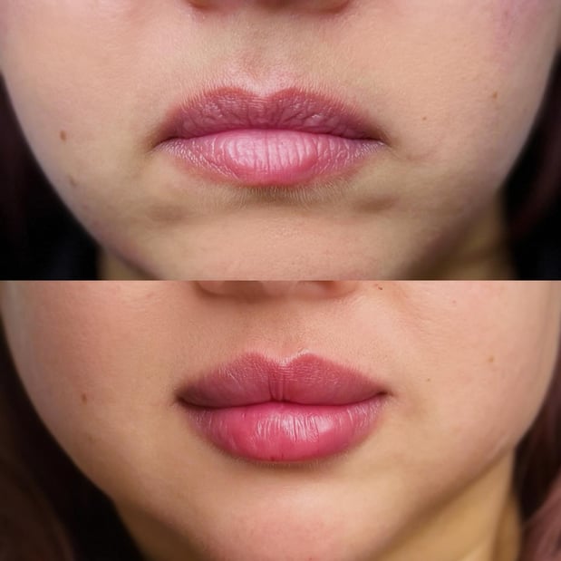 Images RAVE Spa & Clinic