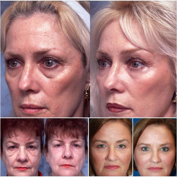 Images Renew Body Contouring & MedSpa