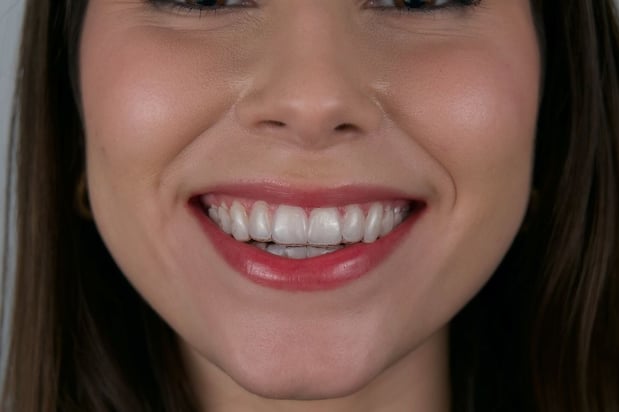 Images Gables iSmile
